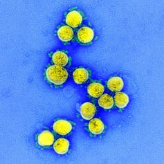 Transmission electron micrograph of SARS-CoV-2 virus particles. Image captured and colour-enhanced at the NIAID Integrated Research Facility. (NIAID), CC BY
